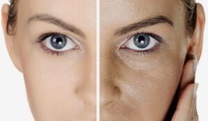 dogru nemlendiriciyi secmek