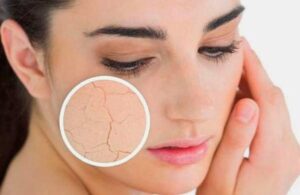 dogru nemlendiriciyi bulmak