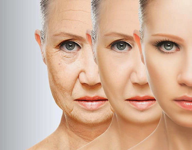 Wrinkle-treatment_1-1 Wrinkle-treatment_1-1